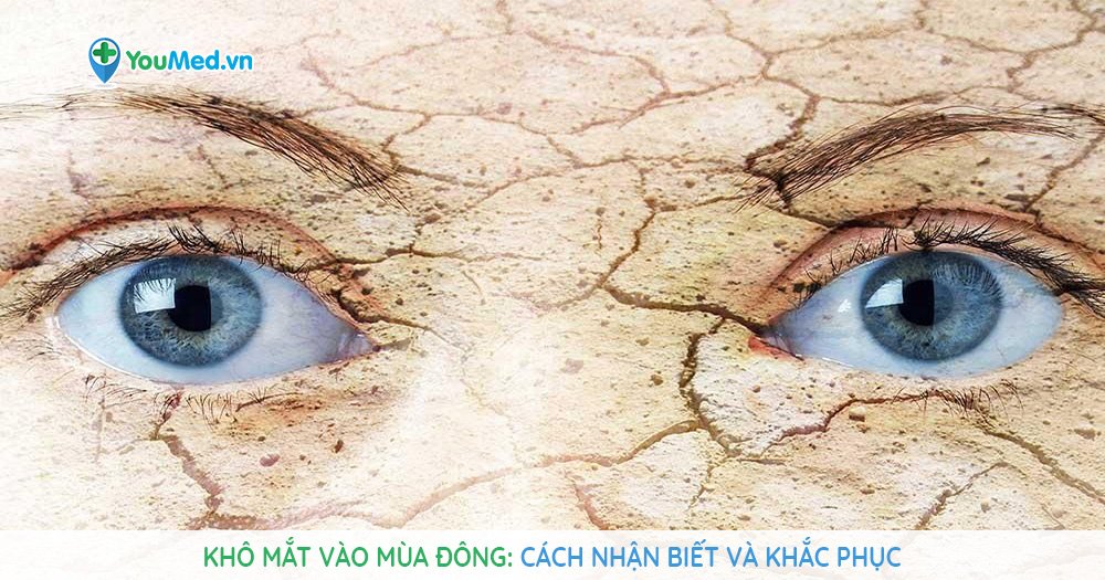 Khô mắt vào mùa đông: Cách nhận biết và khắc phục