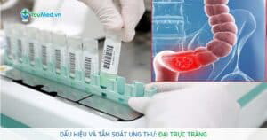 Dấu hiệu và tầm soát ung thư đại trực tràng