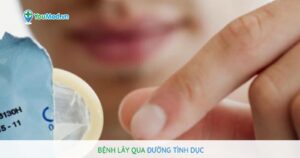 Những bệnh có thể lây qua đường tình dục