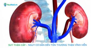 Suy thận cấp: Nguy cơ dẫn đến tổn thương thận vĩnh viễn