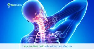 Y học thường thức: Gãy xương cột sống cổ