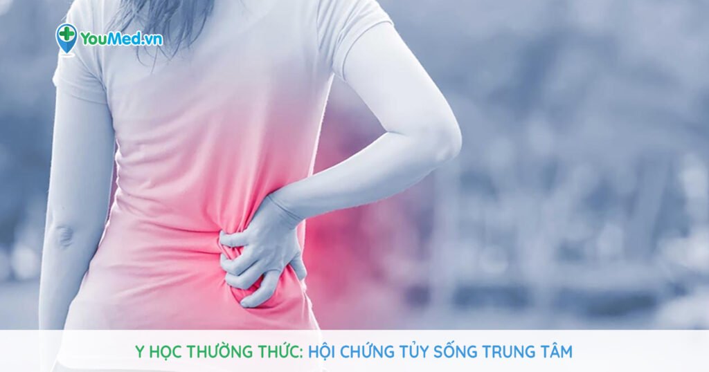 Y học thường thức: Hội chứng tủy sống trung tâm