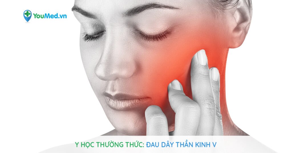 Y học thường thức: Đau dây thần kinh V