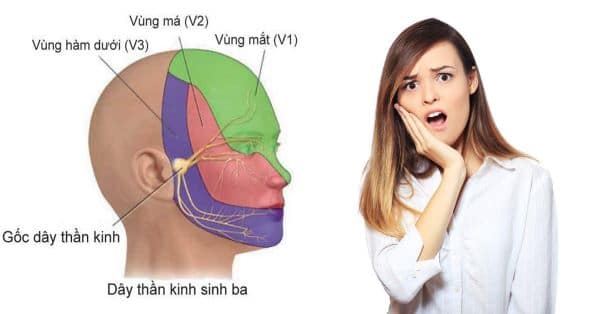 đau dây thần kinh v