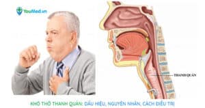 Khó thở thanh quản: Dấu hiệu, nguyên nhân và cách điều trị