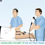 những điều cần biết về nội soi trực tràng