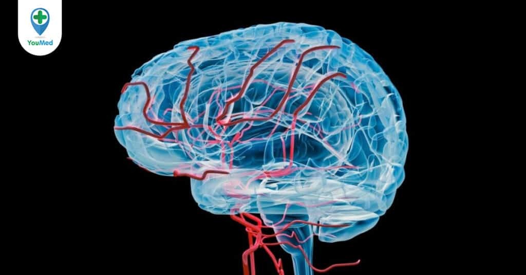 Sa sút trí tuệ do mạch máu: Nguyên nhân, triệu chứng và cách điều trị