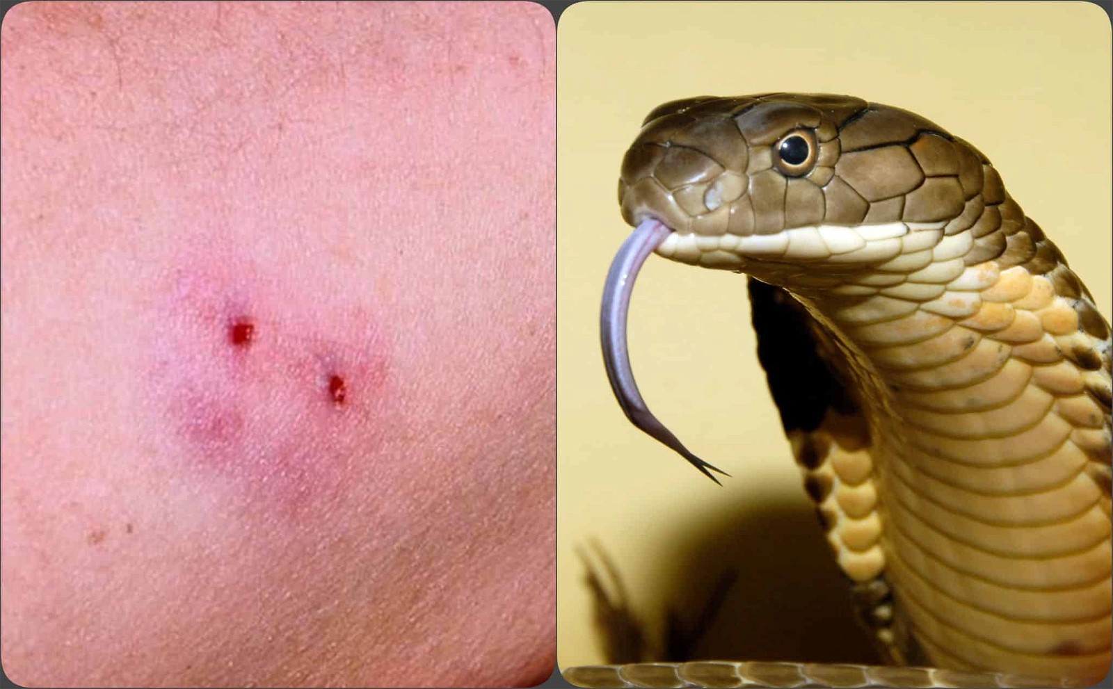 Nọc rắn có thể gây phá hủy hồng cầu và dẫn đến tình trạng nguy hiểm cho cơ thể