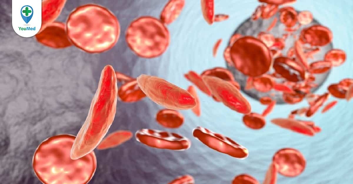 Thiếu máu đẳng sắc đẳng bào có thể ảnh hưởng đến sức khỏe như thế nào?
