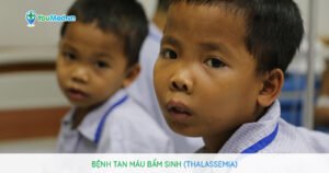 Bệnh tan máu bẩm sinh (Thalassemia): nguyên nhân, triệu chứng và cách điều trị