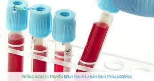 Phòng ngừa di truyền bệnh tan máu bẩm sinh (Thalassemia)
