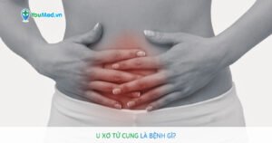 U xơ cơ tử cung là bệnh gì? Nguyên nhân, phân loại và triệu chứng