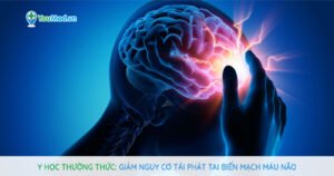 Y học thường thức: Giảm nguy cơ tái phát tai biến mạch máu não