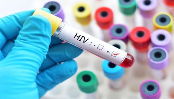 HIV bệnh lây qua đường tình dục