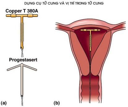 Giáo dục giới tính tuổi teen 2 