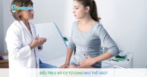 Điều trị u xơ-cơ tử cung như thế nào?