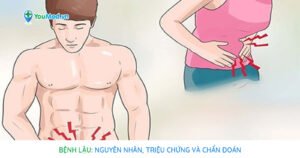 Bệnh lậu: Nguyên nhân, triệu chứng và chẩn đoán