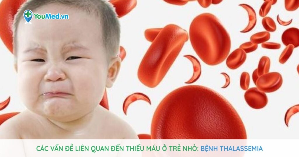 Các vấn đề liên quan đến thiếu máu ở trẻ: Bệnh Thalassemia
