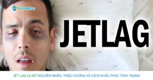 Jet lag là gì? Nguyên nhân, triệu chứng, cách khắc phục