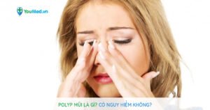 Polyp mũi là gì? Nguyên nhân, triệu chứng và cách điều trị