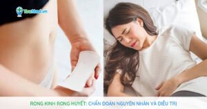 Rong kinh rong huyết: Chẩn đoán nguyên nhân và điều trị