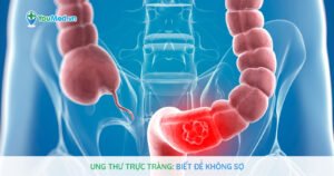 Ung thư trực tràng: Biết để không sợ