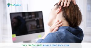 Bệnh lý động mạch cảnh: nguyên nhân, triệu chứng và cách điều trị