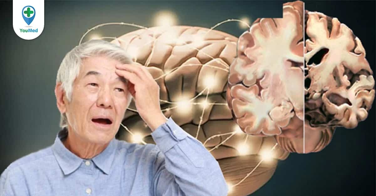 Các thuốc cung cấp cho người lớn tuổi có thể giúp cải thiện trí nhớ của họ, nhưng sử dụng chúng có phải là giải pháp tốt nhất hay không, vì sao?