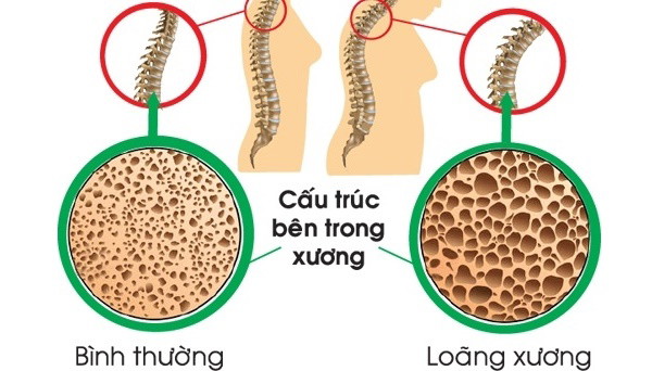 Cấu trúc tổ ong bên trong xương