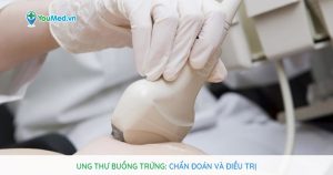 Ung thư buồng trứng: Chẩn đoán và điều trị