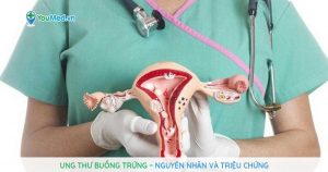 Bệnh ung thư buồng trứng: Nguyên nhân và triệu chứng thường gặp