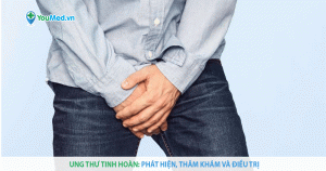 Ung thư tinh hoàn: Phát hiện, thăm khám và điều trị