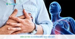 Viêm cơ tim và những điều bạn nên biết