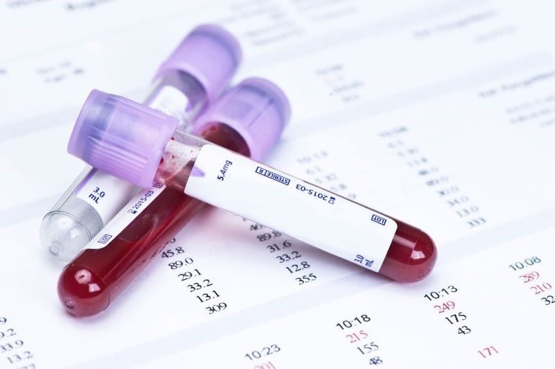 Xét nghiệm máu giúp chẩn đoán nhiễm HIV