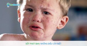 Sốt phát ban: Những điều cần biết