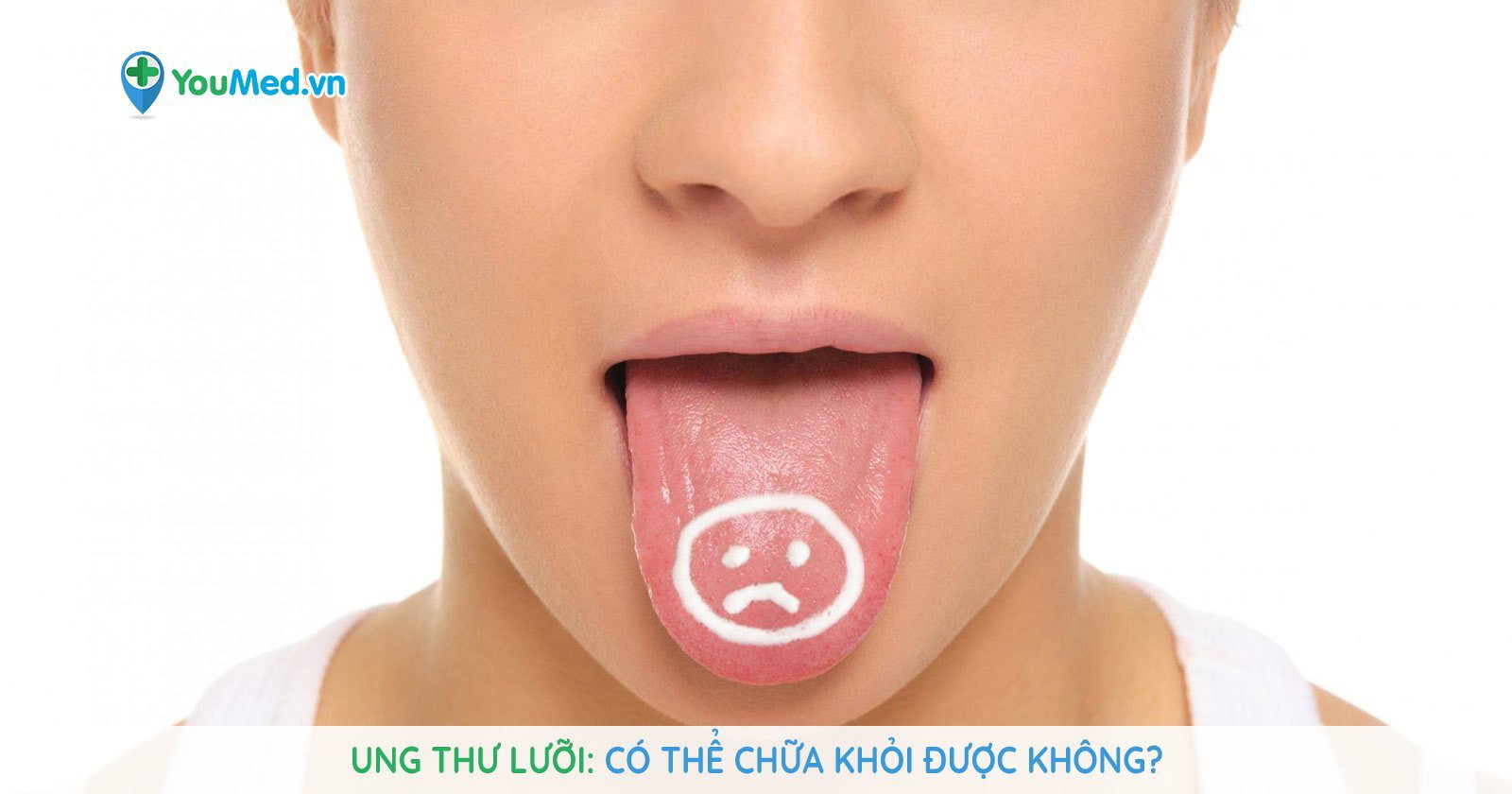 Những lưu ý trong phòng ngừa ung thư lưỡi