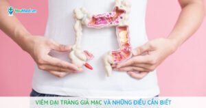 Viêm đại tràng giả mạc: Những điều cần biết