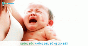 Dị ứng sữa: những điều bố mẹ cần biết