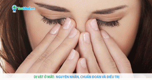 Dị vật ở mắt: Nguyên nhân, chẩn đoán và điều trị