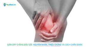 Giãn dây chằng đầu gối : Nguyên nhân, triệu chứng và cách chẩn đoán