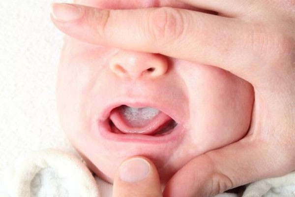 Từ trẻ sơ sinh đến 3 tháng tuổi có thể là bị một số phản ứng của thuốc Tienam gây hại