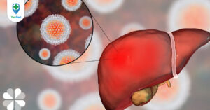 Viêm gan A: Con đường lây lan, cách điều trị và phòng ngừa