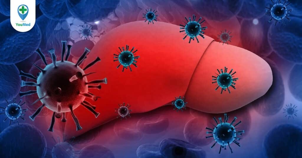 Viêm gan B và chủng ngừa Viêm gan B: Một số điều cần biết
