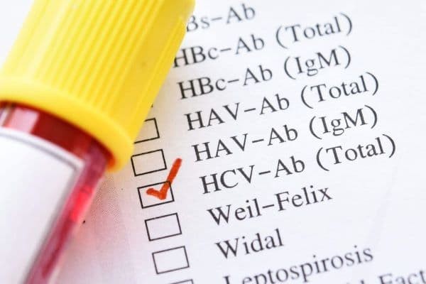 xét nghiệm kháng thể HCV-Ab