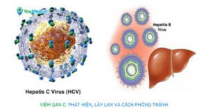 Viêm gan C: Phát hiện, lây lan và cách phòng tránh