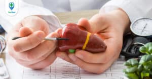 Viêm gan mạn tính: Nguyên nhân, triệu chứng và điều trị