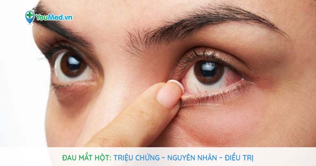 Đau mắt hột: Triệu chứng – Nguyên nhân – Điều trị