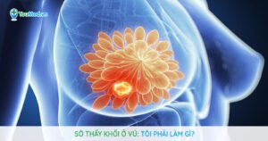 Sờ thấy khối u ở vú: Tôi phải làm gì?