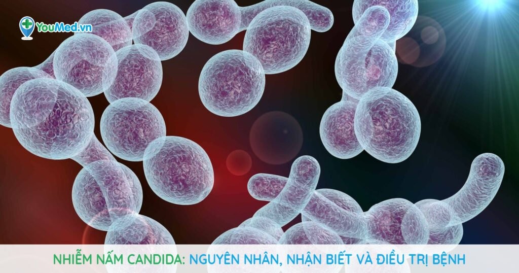 Nhiễm nấm Candida: Nguyên nhân, nhận biết và điều trị bệnh