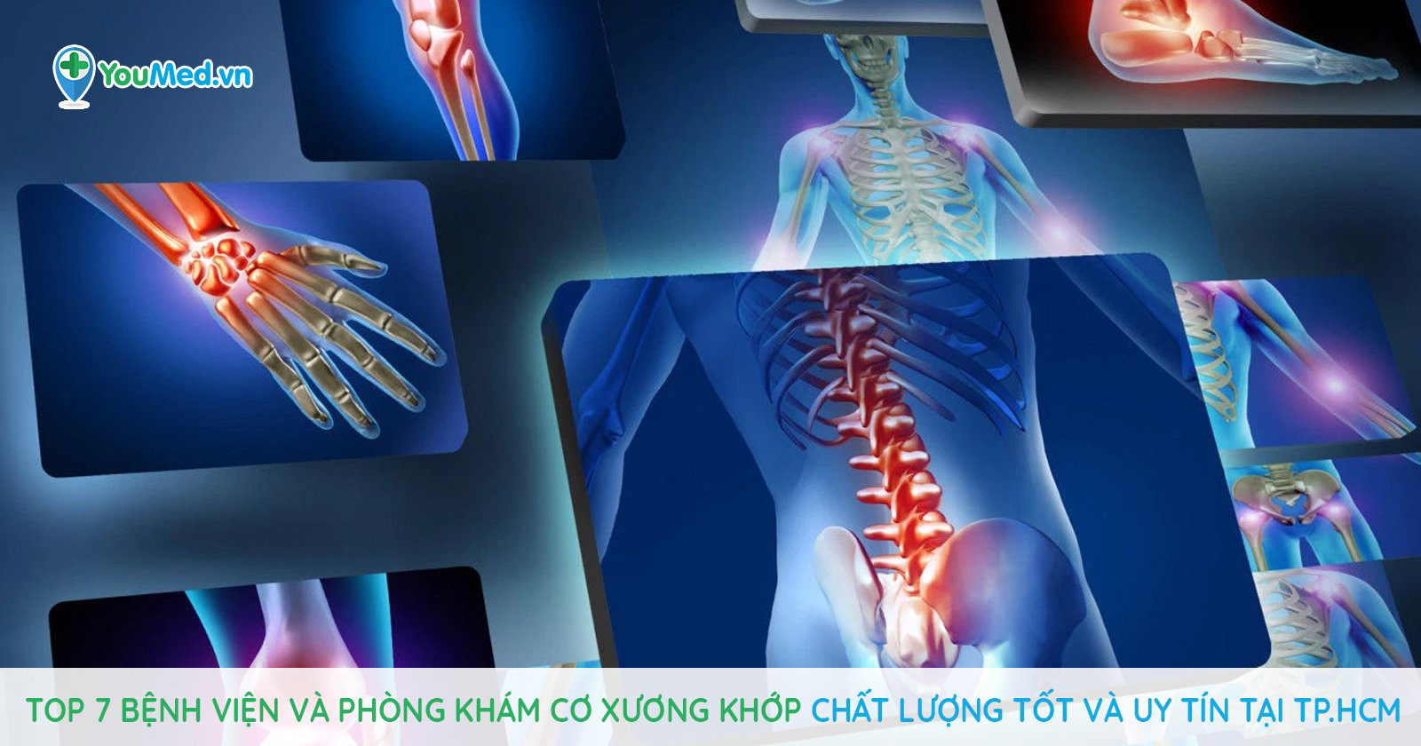 Top 7 Bệnh Viện Va Phong Kham Cơ Xương Khớp Chất Lượng Tốt Va Uy Tin Tại Tp Hcm